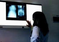 Symptoms of the Final Stage of Liver Cancer