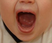 Reasons for Bad Breath in Toddlers