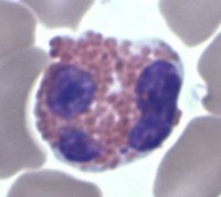 Treatment for Low White Blood Cells