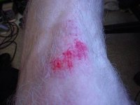 How Long Does it Take a Skinned Knee to Heal?