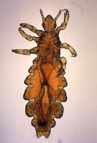 Head Louse (Public Domain, Wiki Commons)