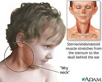 Causes of Facial Asymmetry