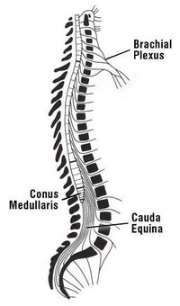 Home Remedy for a Pinched Nerve in the Neck