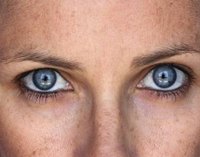Too much sun may cause actinic keratosis.