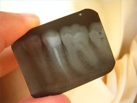 Get Emergency Dental Care