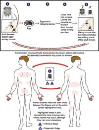 Mange Treatment for Humans