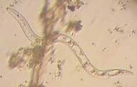 Kill Roundworms in Humans