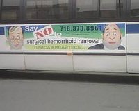 How Long Does a Hemroid Last?