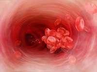 Blood clots