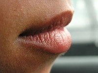 Lip Numbness Causes