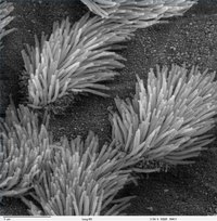 Scanning electron microscope image of cilia in lungs (public domain)