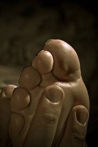 Home Remedies for Diabetic Neuropathy