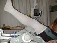 Compression stocking after knee surgery