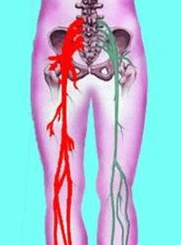 Causes of Muscle Soreness & Night Leg Cramps