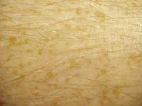 How Long Does a Skin Cell Live?