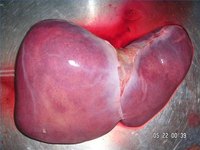 A human liver taken during an autopsy