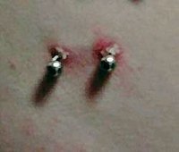 An infected surface piercing