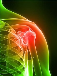 Calcium Deposit Symptoms