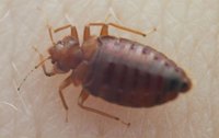 Treat Bed Bug Bites
