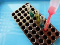 What Is a GGTP Blood Test?