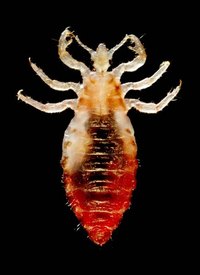 Image of Head Lice