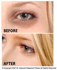 Tips for removing dark circles