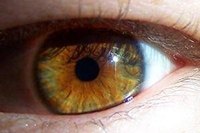 The Average Cost of PRK Eye Surgery