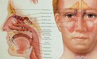 What Is Pan Sinus Disease?