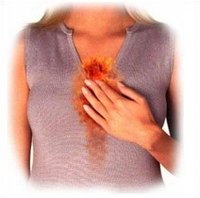 Get Rid of Heartburn Quickly