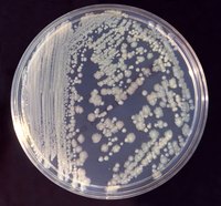 What Type of Bacteria Is Enterobacter Cloacae?