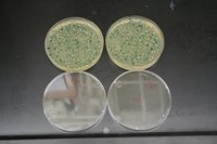 What Antibiotics Cure a Bladder Infection?