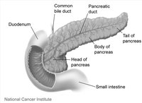 End Stages of Pancreatic Cancer