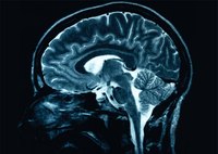 Symptoms of a Mild Head Injury