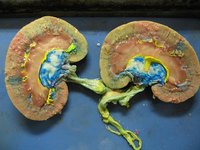 Early Signs of Kidney Failure
