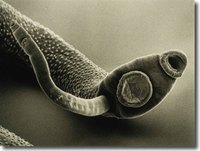 Tapeworm.