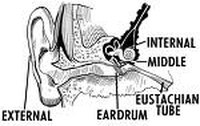 Fungal Ear Infections