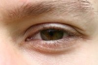 Eyes can become irritated, red or itchy for a number of reasons.