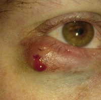 http://123medicine.blogspot.com