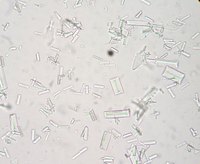Struvite (magnesium ammonium phosphate) crystals found microscopically in a urinalysis of a dog with a bladder infection.