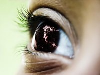 Conjuctive Eye Infection
