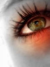 Eye Staph Infections
