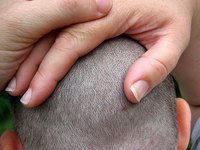 Try a natural remedy for hair loss.