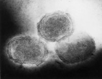 Can You Get Rid of Molluscum Contagiosum?