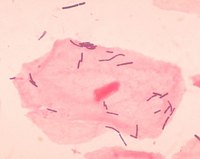 Is Bacterial Vaginosis Contagious?