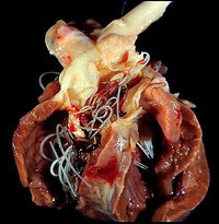 Human Heartworm Disease