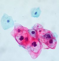 How Long Does HPV Last in Your Body?