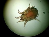 Can You Get Scabies From Playing in the Dirt?
