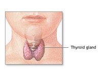 Signs & Symptoms of Thyroid Problems in Adolescent Girls