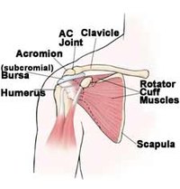 Pain Management After Rotator Cuff Surgery