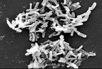 Sepsis From a C-Diff Infection